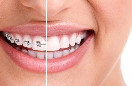 When To Look For An Orthodontist